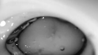 Point Of View: Busting a fountain inwards my ovaries